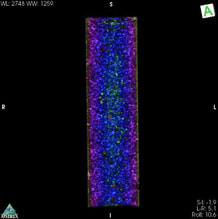 CT SCAN IMAGE ​CONCRETE FORMULATION WITH ANTI-HYDRO